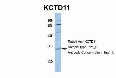 Western Blot: KCTD11 Antibody [NBP1-80211] - Analysis of 721_B cell lysate. Antibody Dilution: 1.0 ug/ml.