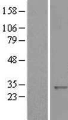 Western Blot: KCTD11 Overexpression Lysate (Adult Normal) [NBL1-12208] Left-Empty vector transfected control cell lysate (HEK293 cell lysate); Right -Over-expression Lysate for KCTD11.