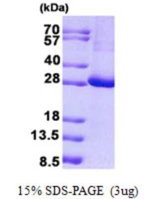 SDS-Page: KCTD11 Protein [NBP2-23352]