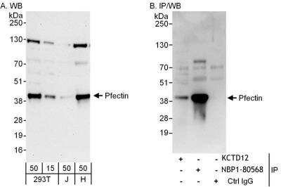 Immunoprecipitation KCTD12 Antibody - BSA Free