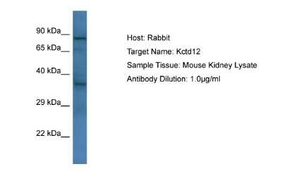 Western Blot: KCTD12 Antibody [NBP2-84114] - Host: Rabbit. Target Name: Kctd12. Sample Type: Mouse Kidney lysates. Antibody Dilution: 1.0ug/ml
