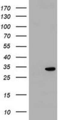 Western Blot: KCTD14 Antibody (OTI2E9) - Azide and BSA Free [NBP2-72171] - Analysis of HEK293T cells were transfected with the pCMV6-ENTRY control (Left lane) or pCMV6-ENTRY KCTD14.