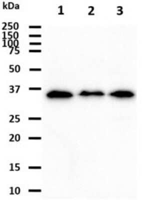 Western Blot: KCTD15 Antibody (2B11) [NBP2-60232] - The cell lysates (40ug) were resolved by SDS-PAGE, transferred to PVDF membrane and probed with anti-human KCTD15 (1:1000). Proteins were visualized using a goat anti-mouse secondary antibody conjugated to HRP and an ECL detection system.Lane 1 : HeLa cell lysateLane 2 : NIH/3T3 cell lysateLane 3 : K562 cell lysate