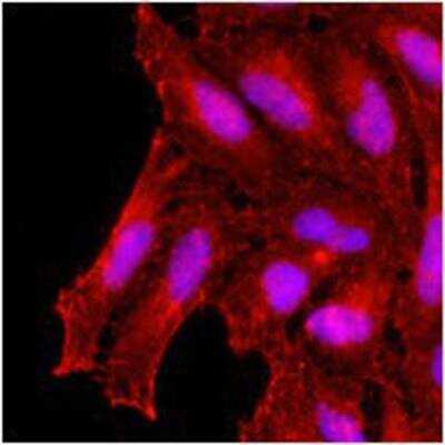 Immunocytochemistry/Immunofluorescence: KCTD15 Antibody (AT4C3) [NBP1-49429] - Human HeLa cells stained with monoclonal anti-human KCDT15 antibody (1:500) with Texas Red (Red). Nucleus was stained by Hoechst 33342 (Blue).