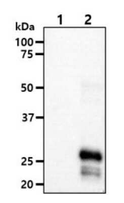 Western Blot: KCTD15 Antibody (AT4C3) [NBP1-49429] - The cell lysates (10ug) were resolved by SDS-PAGE,transferred to PVDF membrane and probed with anti-humanKCTD15 antibody (1:1000). Proteins were visualized using agoat anti-mouse secondary antibody conjugated to HRP andan ECL detection system.Lane 1 : 293T cell lysateLane 2 : KCTD15 Transfected 293T cell lysate