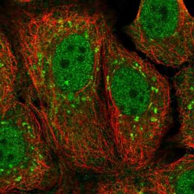 Immunocytochemistry/Immunofluorescence: KCTD15 Antibody [NBP2-14148] - Immunofluorescent staining of human cell line MCF7 shows localization to nucleoplasm & the Golgi apparatus.