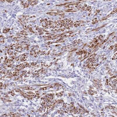 Immunohistochemistry-Paraffin: KCTD15 Antibody [NBP2-14148] - Staining of human smooth muscle shows strong cytoplasmic positivity in smooth muscle cells.