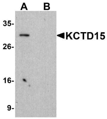 Western Blot: KCTD15 Antibody [NBP1-77007] - Analysis in HeLa cell lysate with antibody at 1ug/ml in (A) the absence and (B) the presence of blocking buffer.