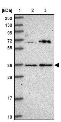 Western Blot: KCTD15 Antibody [NBP2-14148] - Lane 1: Marker [kDa] 250, 130, 95, 72, 55, 36, 28, 17, 10Lane 2: Human cell line RT-4Lane 3: Human cell line U-251MG sp