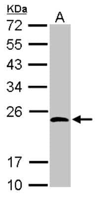 Western Blot: KCTD15 Antibody [NBP2-17030] - Sample (30 ug of whole cell lysate) A: NT2D1 12% SDS PAGE gel, diluted at 1:1000.