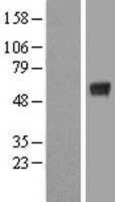 Western Blot KCTD15 Overexpression Lysate