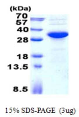 SDS-PAGE Recombinant Human KCTD15 His Protein