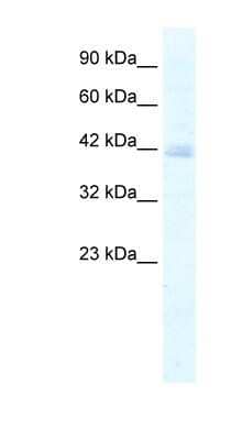 Western Blot: KCTD18 Antibody [NBP1-80093] - Titration: 5.0ug/ml, Positive Control: Jurkat cell lysate.