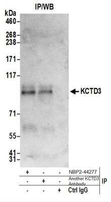 Immunoprecipitation: KCTD3 Antibody [NBP2-44277] - Western Blot of Immunoprecipitates. Samples: Whole cell lysate (0.5 or 1.0 mg per IP reaction; 20% of IP loaded) from HeLa cells prepared using NETN lysis buffer. KCTD3 was also immunoprecipitated by another rabbit anti-KCTD3 antibody.