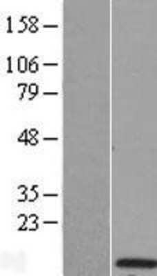 Western Blot KCTD4 Overexpression Lysate