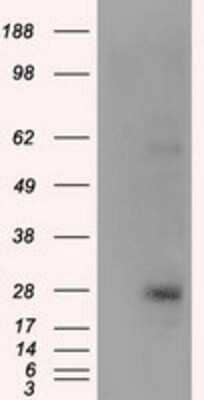 Western Blot: KCTD5 Antibody (3C8) [NBP2-02414] - HEK293T cells were transfected with the pCMV6-ENTRY control (Left lane) or pCMV6-ENTRY KCTD5 (Right lane) cDNA for 48 hrs and lysed. Equivalent amounts of cell lysates (5 ug per lane) were separated by SDS-PAGE and immunoblotted with anti-KCTD5.