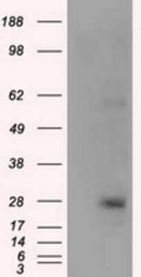 Western Blot: KCTD5 Antibody (OTI3C8) - Azide and BSA Free [NBP2-71955] - HEK293T cells were transfected with the pCMV6-ENTRY control (Left lane) or pCMV6-ENTRY KCTD5 (Right lane) cDNA for 48 hrs and lysed. Equivalent amounts of cell lysates (5 ug per lane) were separated by SDS-PAGE and immunoblotted with anti-KCTD5.