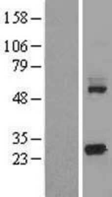 Western Blot: KCTD5 Overexpression Lysate (Adult Normal) [NBL1-12216] Left-Empty vector transfected control cell lysate (HEK293 cell lysate); Right -Over-expression Lysate for KCTD5.