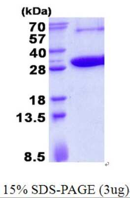 SDS-Page: KCTD5 Protein [NBP2-23355]