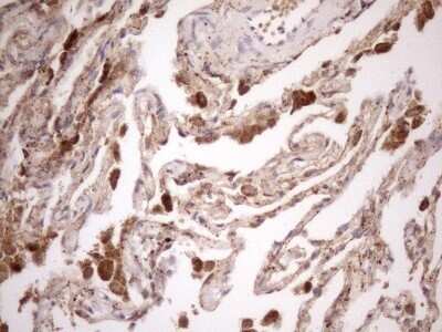 Immunohistochemistry: KCTD9 Antibody (OTI2G8) - Azide and BSA Free [NBP2-71968] - Analysis of Human lung tissue. (Heat-induced epitope retrieval by 1mM EDTA in 10mM Tris buffer (pH8.5) at 120C for 3 min)