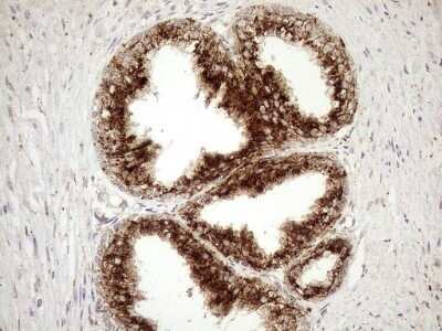 Immunohistochemistry: KCTD9 Antibody (OTI2G8) - Azide and BSA Free [NBP2-71968] - Analysis of Human prostate tissue. (Heat-induced epitope retrieval by 1mM EDTA in 10mM Tris buffer (pH8.5) at 120C for 3 min)
