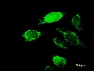 Immunocytochemistry/Immunofluorescence: KChIP2 Antibody [H00030819-B01P] - Analysis of purified antibody to KCNIP2 on HeLa cell. (antibody concentration 10 ug/ml)