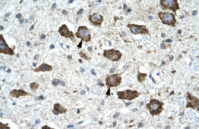 Immunohistochemistry: KChIP2 Antibody [NBP3-10370] - Immunohistochemical analysis of human brain