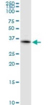 Western Blot: KChIP2 Antibody [H00030819-D01P] - Analysis of KCNIP2 expression in A-431.