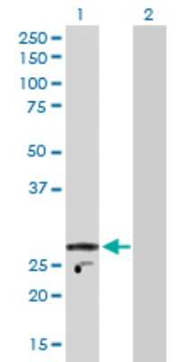 Western Blot: KChIP2 Antibody [H00030819-D01P] - Analysis of KCNIP2 expression in transfected 293T cell line by KCNIP2 polyclonal antibody.Lane 1: KCNIP2 transfected lysate(30.90 KDa).Lane 2: Non-transfected lysate.