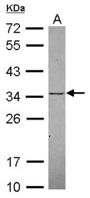Western Blot: KChIP2 Antibody [NBP2-17026] - Sample (30 ug of whole cell lysate) A: Raji 12% SDS PAGE gel, diluted at 1:1000.