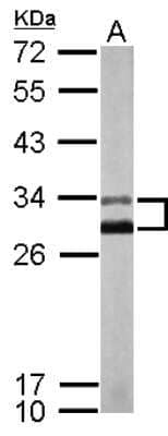 Western Blot: KChIP2 Antibody [NBP2-17026] - Sample (50 ug of whole cell lysate) A: Mouse Brain, 12% SDS PAGE gel, diluted at 1:1000.