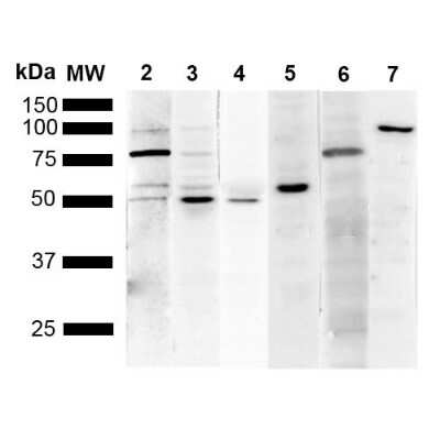 Western Blot: KDEL Antibody (1F2) [NBP2-61924] - Western Blot analysis of Human Cervical cancer cell line (HeLa) lysate showing detection of Multiple KDEL protein using Mouse Anti-KDEL Monoclonal Antibody, Clone 1F2 (NBP2-61924). Lane 1: Molecular Weight Ladder (MW). Lane 2: Anti-KDEL (NBP2-61924). Lane 3: Anti-KDEL control (SPC-109). Lane 4: Anti-PDI control (SPC-114). Lane 5: Anti-Calreticulin control (SPC-122). Lane 6: Anti-GRP78 control (SPC-107). Lane 7: Anti-GRP94 control (SPC-101).. Load: 10 ug. Block: 5% Skim Milk powder in TBST. Primary Antibody: Mouse Anti-KDEL Monoclonal Antibody (NBP2-61924) at 1:1000 for 2 hours at RT. Secondary Antibody: Goat Anti-Mouse IgG:HRP at 1:5000 for 1 hour at RT. Color Development: ECL solution for 5 min in RT. Predicted/Observed Size: Multiple.