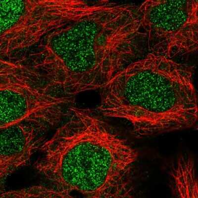 Immunocytochemistry/Immunofluorescence: KDEL Antibody [NBP2-57105] - Staining of human cell line HEK 293 shows localization to nucleus.