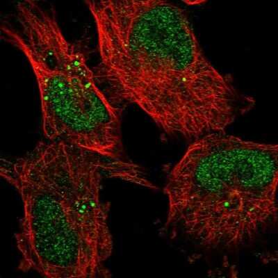 Immunocytochemistry/ Immunofluorescence KDELC2 Antibody