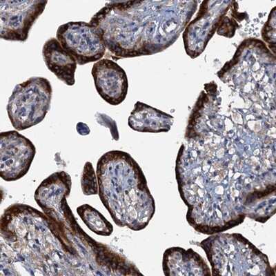 Immunohistochemistry-Paraffin: KDELC2 Antibody [NBP1-92046] - Staining of human placenta shows strong cytoplasmic positivity in trophoblastic cells.