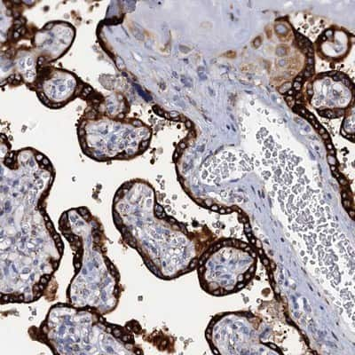 Immunohistochemistry-Paraffin KDELC2 Antibody