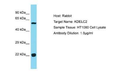 Western Blot: KDELC2 Antibody [NBP2-87669] - Host: Rabbit. Target Name: KDELC2. Sample Type: HT1080 Whole Cell lysates. Antibody Dilution: 1.0ug/ml