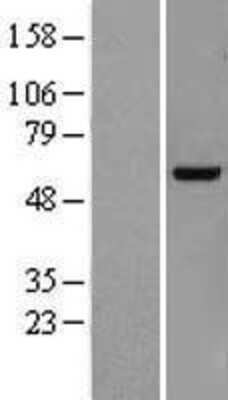 Western Blot: KDELC2 Overexpression Lysate (Adult Normal) [NBL1-12219] Left-Empty vector transfected control cell lysate (HEK293 cell lysate); Right -Over-expression Lysate for KDELC2.