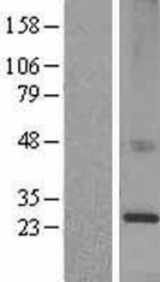 Western Blot: KDELR1 Overexpression Lysate (Adult Normal) [NBL1-12220] Left-Empty vector transfected control cell lysate (HEK293 cell lysate); Right -Over-expression Lysate for KDELR1.