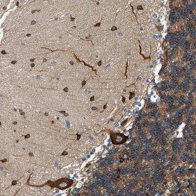 Immunohistochemistry-Paraffin KDELR2 Antibody