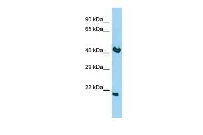 Western Blot: KDELR2 Antibody [NBP2-85140] - Host: Rabbit. Target Name: KDELR2. Sample Type: Fetal Brain lysates. Antibody Dilution: 1.0ug/ml