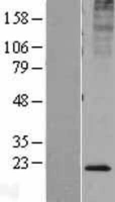 Western Blot: KDELR2 Overexpression Lysate (Adult Normal) [NBL1-12221] Left-Empty vector transfected control cell lysate (HEK293 cell lysate); Right -Over-expression Lysate for KDELR2.