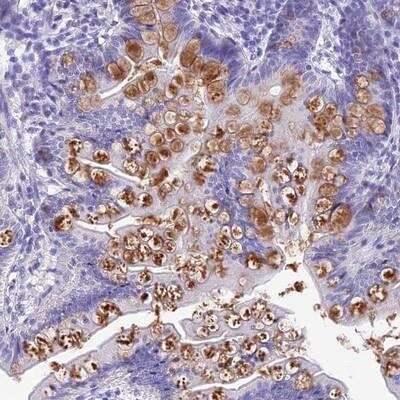 Immunohistochemistry-Paraffin KDELR3 Antibody - BSA Free