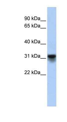 Western Blot KDELR3 Antibody - BSA Free