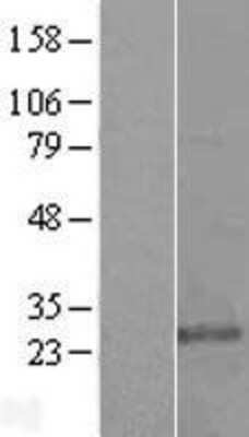 Western Blot KDELR3 Overexpression Lysate