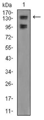 Western Blot: KDM2B Antibody (6F6G11) [NBP2-52467] - Analysis using FBXL10 mouse mAb against A549 (1) cell lysate.