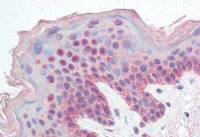 Immunohistochemistry-Paraffin: KDM2B Antibody [NB100-1293] - Staining of paraffin embedded Human Skin. Steamed antigen retrieval with citrate buffer pH 6, AP-staining.