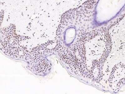 Immunohistochemistry-Paraffin: KDM2B Antibody [NBP2-99310] - Staining of human KDM2B in human skin with rabbit polyclonal antibody at 1:1000 dilution. 