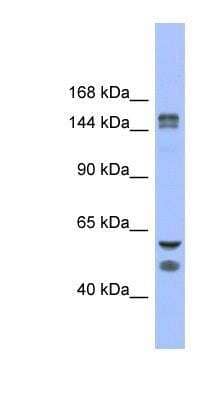 Western Blot: KDM2B Antibody [NBP1-80379] - Human Stomach, concentration 0.2-1 ug/ml.