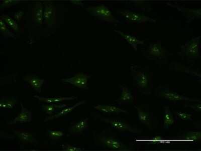 Immunocytochemistry/Immunofluorescence: KDM6A Antibody (4E7) [H00007403-M05] - Analysis of monoclonal antibody to KDM6A on HeLa cell. Antibody concentration 10 ug/ml